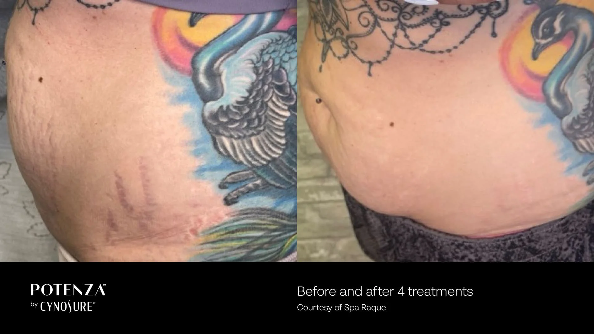 potenza before and after result