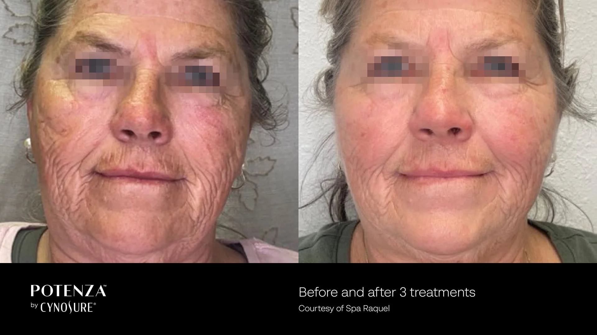 potenza before and after result